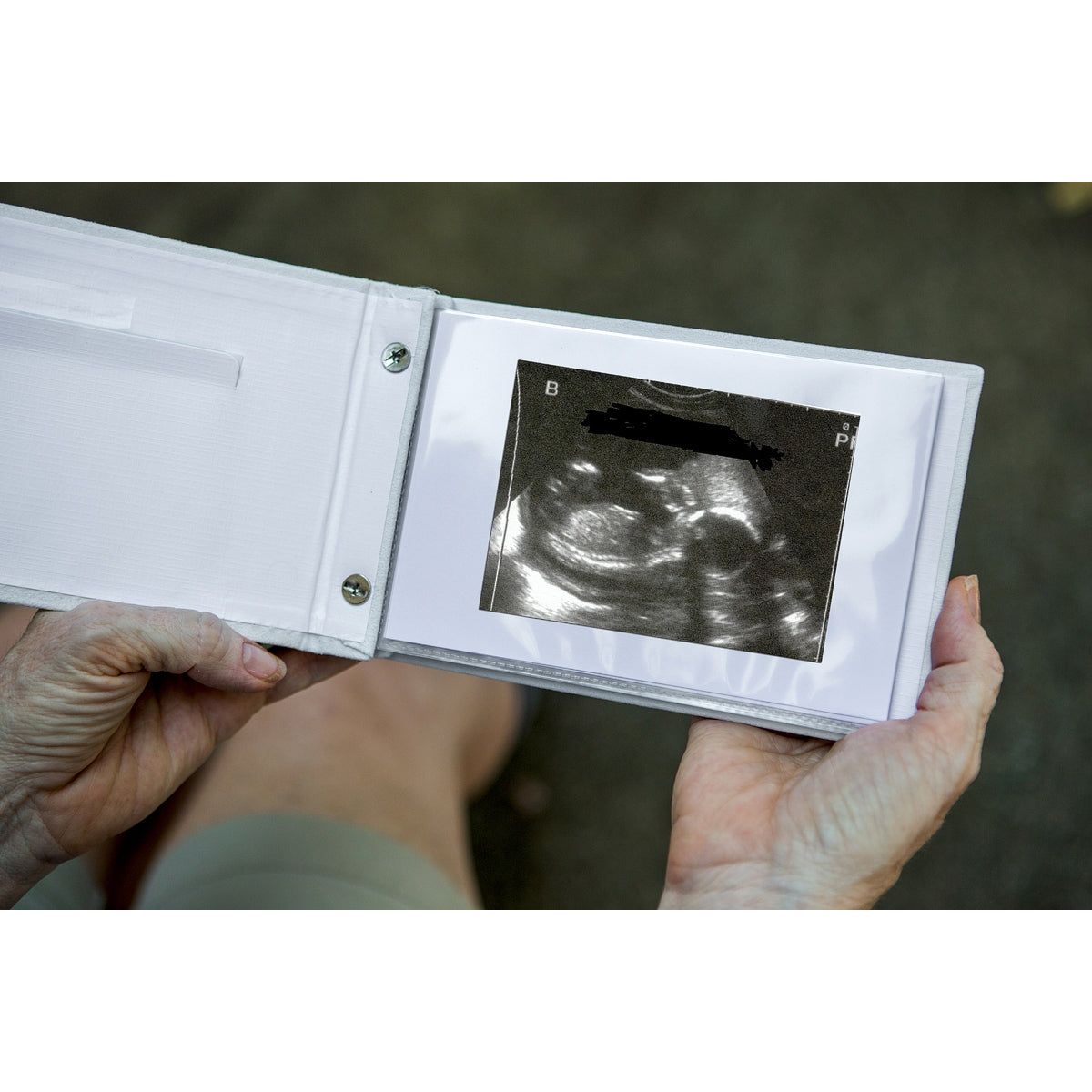 Open photo album being held in hands showing an ultrasound in the plastic sleeve.